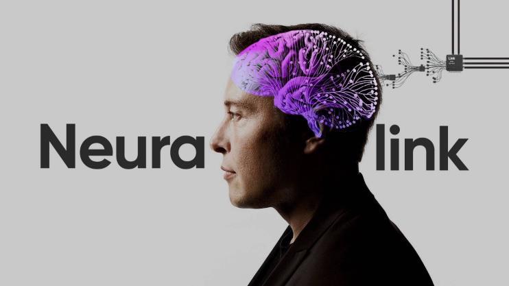 埃隆·马斯克的脑机接口创意产品可能将很快开始人体试验