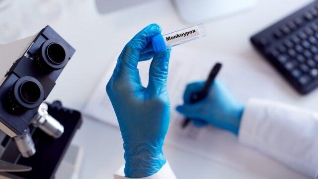 爱尔兰岛报告首例猴痘病例，全球已发现219例
