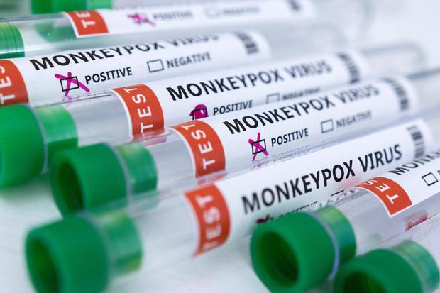 爱尔兰今天又报告了2例猴痘病例，感染人数增至4人