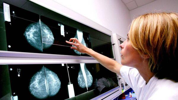 一种被誉为灵丹妙药的新药正在爱尔兰招募乳腺癌患者进行临床试验