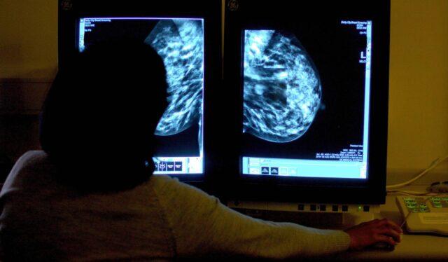 新治疗方案获批，爱尔兰高复发风险乳腺癌患者迎来希望